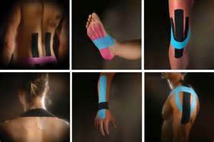 Voorbeelden van medical taping op rug, voet, knie, nek, pols en heup